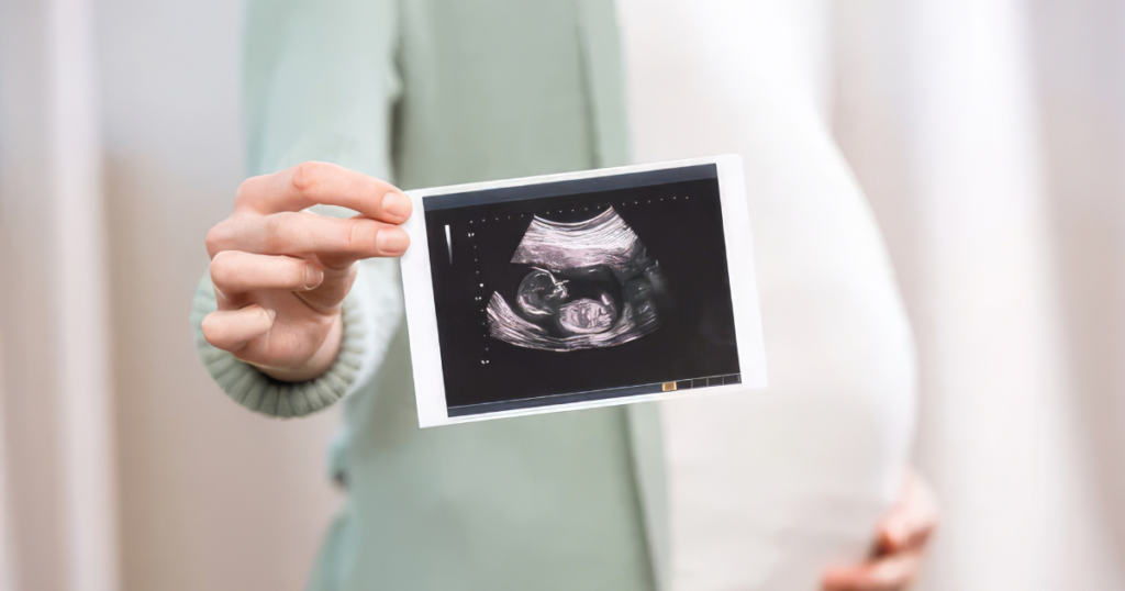 pregnancy-ultrasound